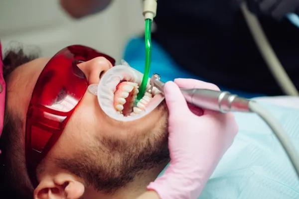 Igiene Dentale Professionale