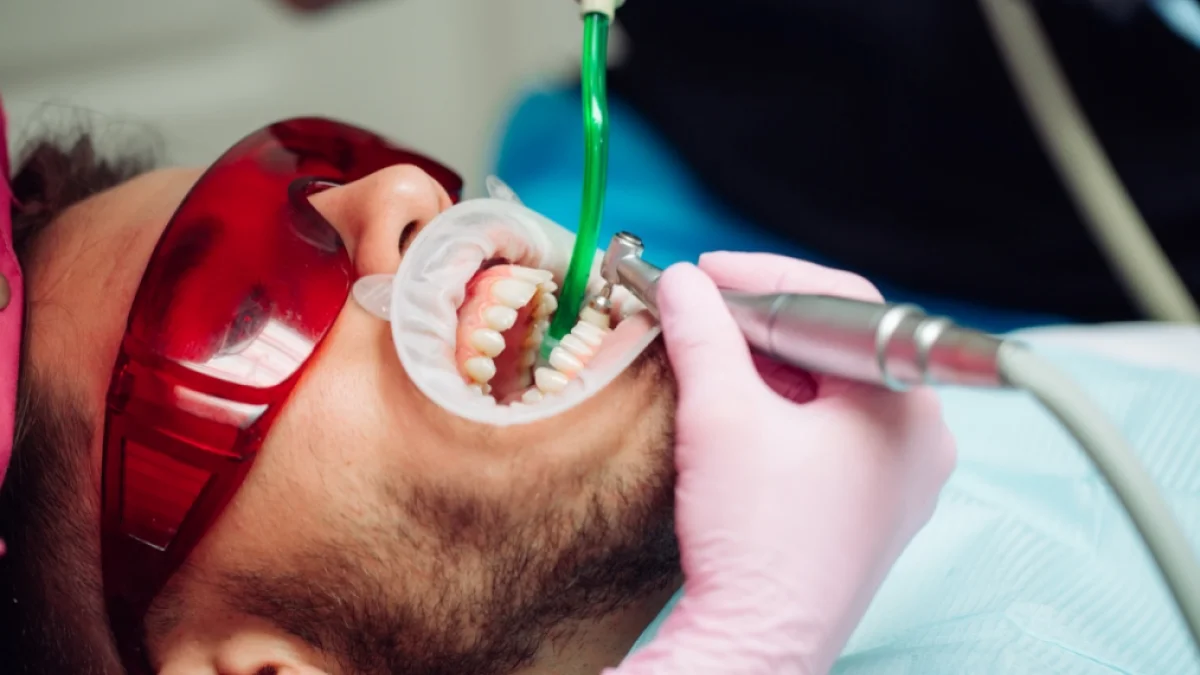 Igiene Dentale Professionale