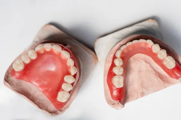 Ponte in Zirconia Full-Arch