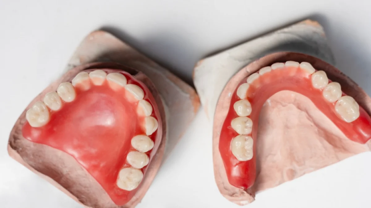 Ponte in Zirconia Full-Arch