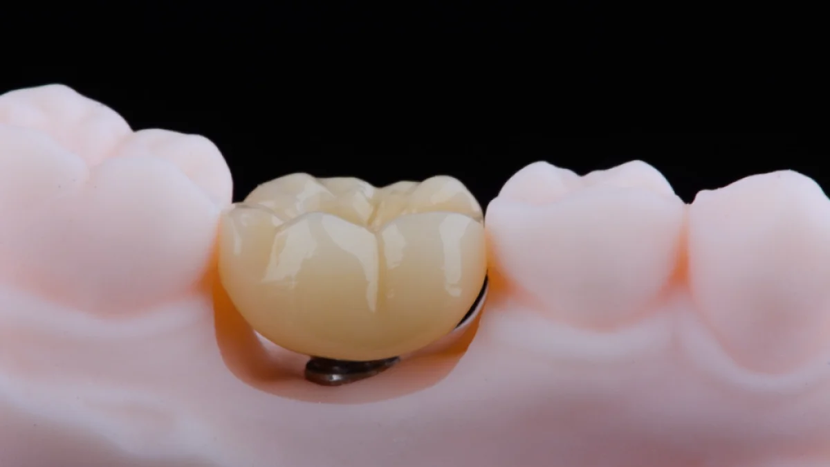 Corona in Zirconia
